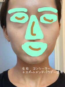 左右共コンシーラー+スポットメンテパウダー塗布写真