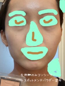 左側のみコンシーラー+スポットメンテパウダー塗布写真