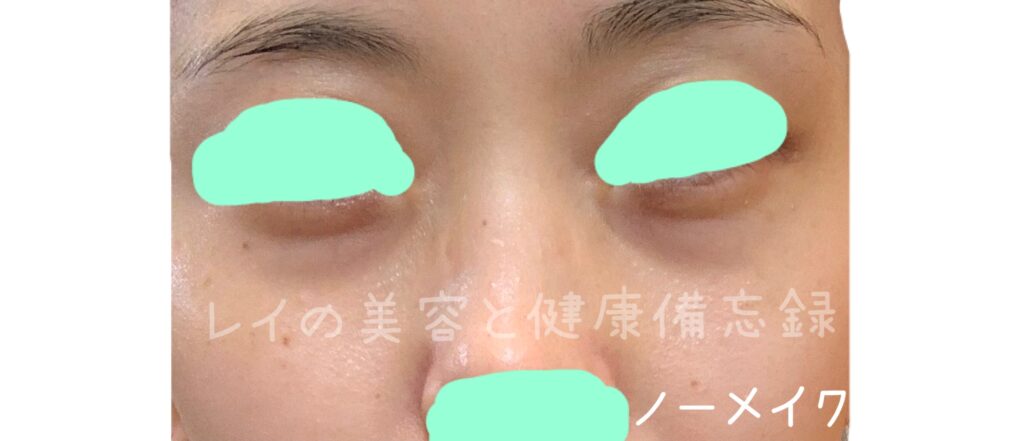 ミュアイススポットメンテパウダーとセザンヌトーンフィルターハイライト比較(顔 ノーメイク)